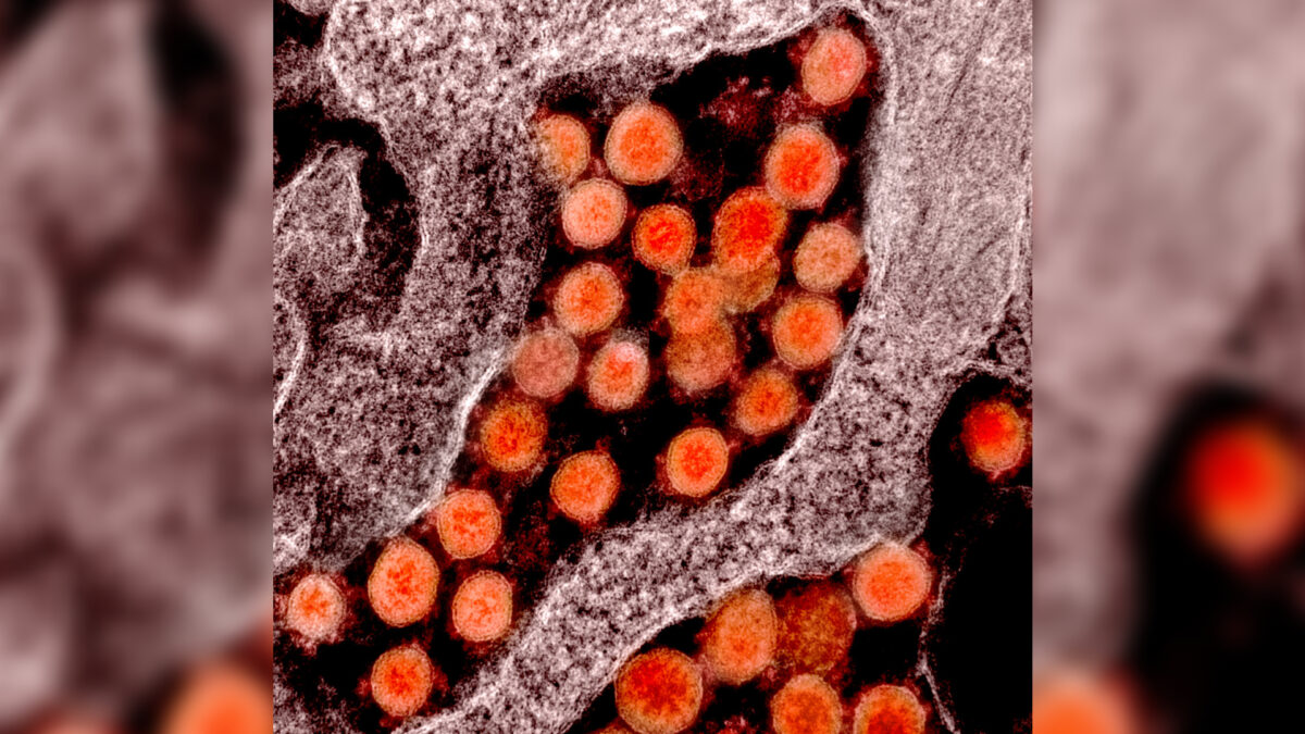 Gli Stati Uniti hanno finanziato laboratori biologici in Ucraina